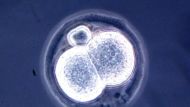 Microscopic View Of A Two Cell Mouse Embryo A Result Of A New And Relatively Simple Cloning Techniq